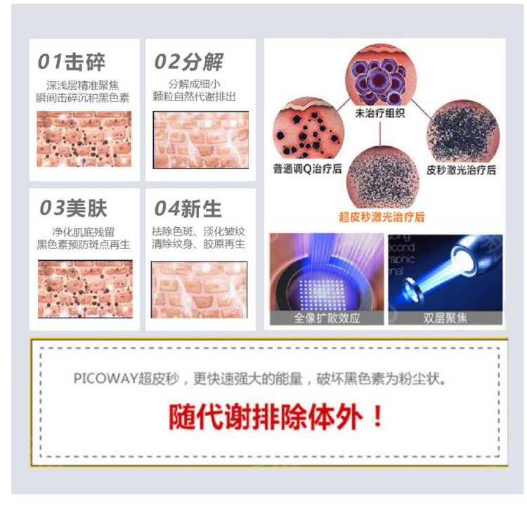 超皮秒激光祛斑表皮斑真皮斑美白嫩肤收缩毛孔美容院用仪器_2cec2b51.jpg