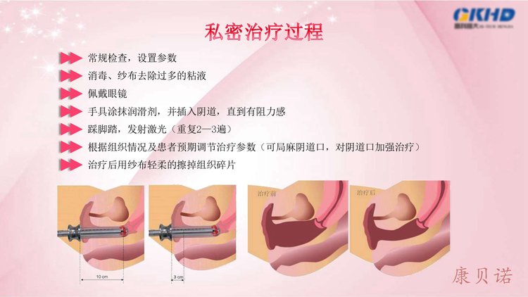 国产多种输出方式功率30W真彩触屏脉冲二氧化碳点阵激光治疗仪_fc252816.jpg